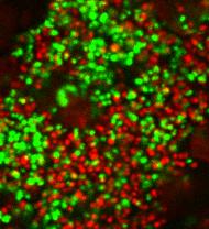 Confocal Laser Scanning Microscopy Image of bacterial biofilm, within the ETT, stained with live/dead Kit