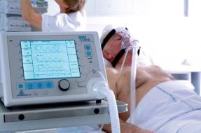 Non Invasive Ventilation