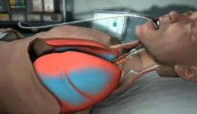 Ventilación Mecánica